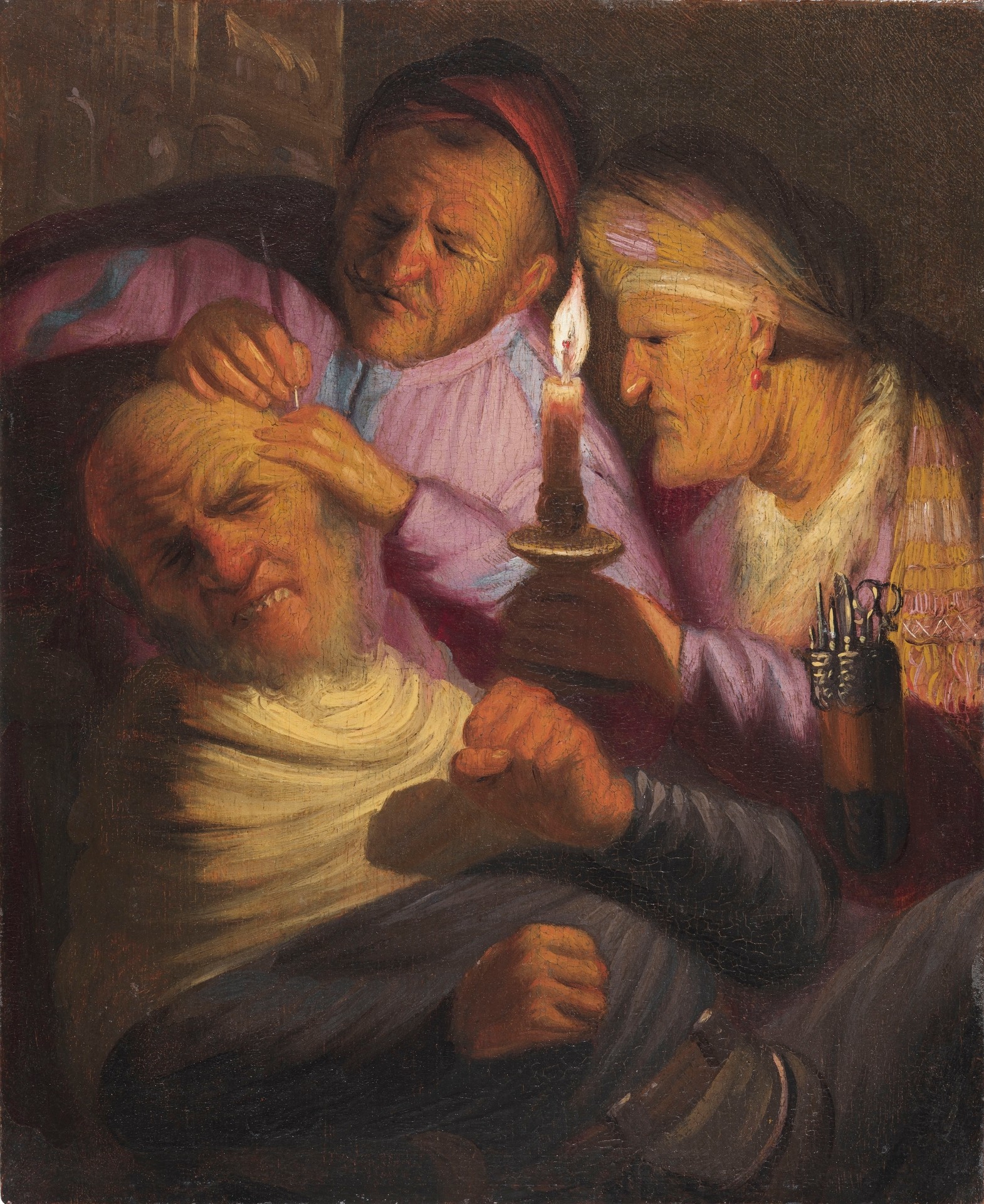 Stone Operation (Allegory of Touch) - by Rembrandt